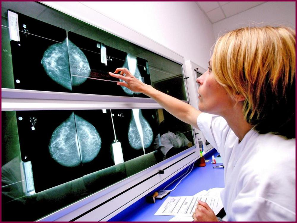 Работа передвижного маммографа в Ильинском районе